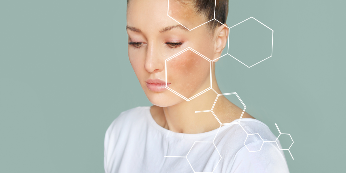 Rutina para piel sensible